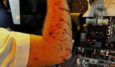 09:03 Unbekanntes Objekt trifft United-Airlines-Flug und zertrümmert Windschutzscheibe - nTV