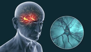 Alzheimer-Forschung: Protein hilft beim Kampf gegen Krebs | Leben & Wissen