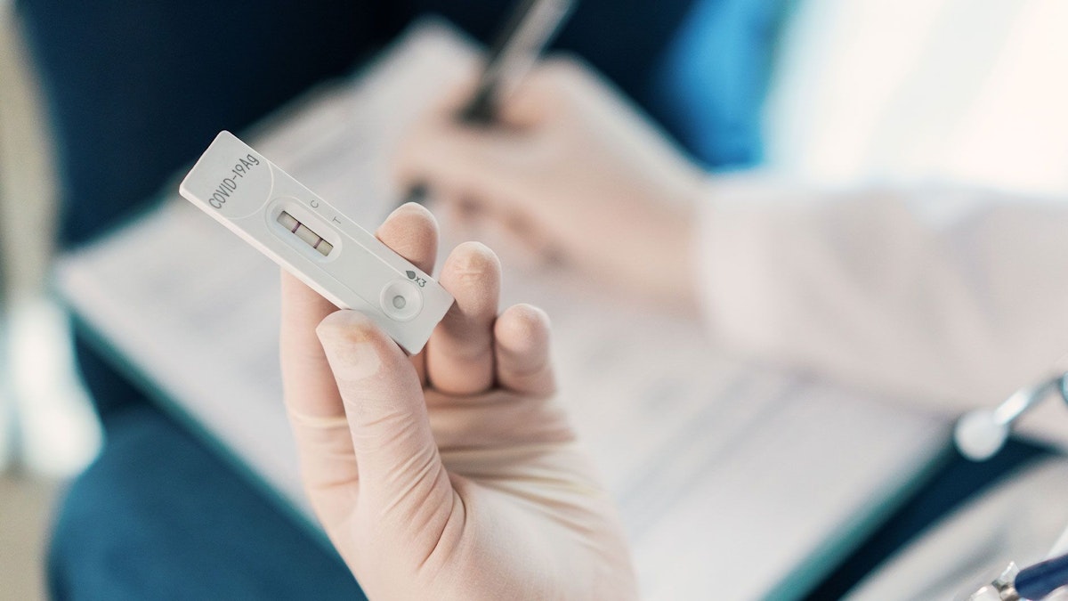 Kosten, Risikogruppen & Ärzte – Coronavirus – wer bekommt die PCR-Tests gratis?