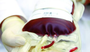 Blutspender in Essen gesucht - Regeln gelockert