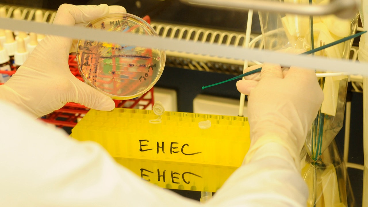 Bio-Sprossen wegen möglicher EHEC-Erreger zurückgerufen