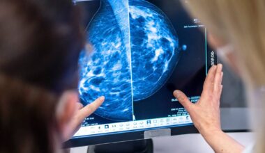 Mönchengladbach: Aktionen zum Pinktober der Krankenhäuser