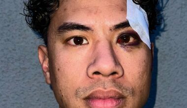 Berlin: Tutty Tran überlebt rassistischen Angriff | Regional