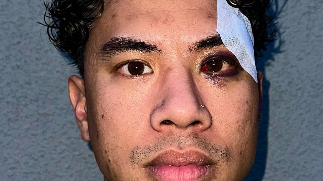 Berlin: Tutty Tran überlebt rassistischen Angriff | Regional