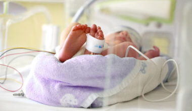 Zeichen zum Welttag - 2.557 Frühchen im UK Tulln: Für sie leuchten die Türme violett