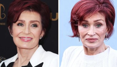 Ozempic-Face mit hohlen Wangen und Falten: Droht nach dem Gewichtsverlust der Gesichtsverlust? - Panorama