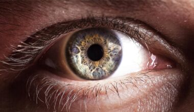 Wenn Adipositas und Fettleber auf Auge und Lunge schlagen