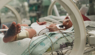 Aufenthalt auf der Intensivstation erhöht bei Frühgeborenen das Risiko für Bluthochdruck