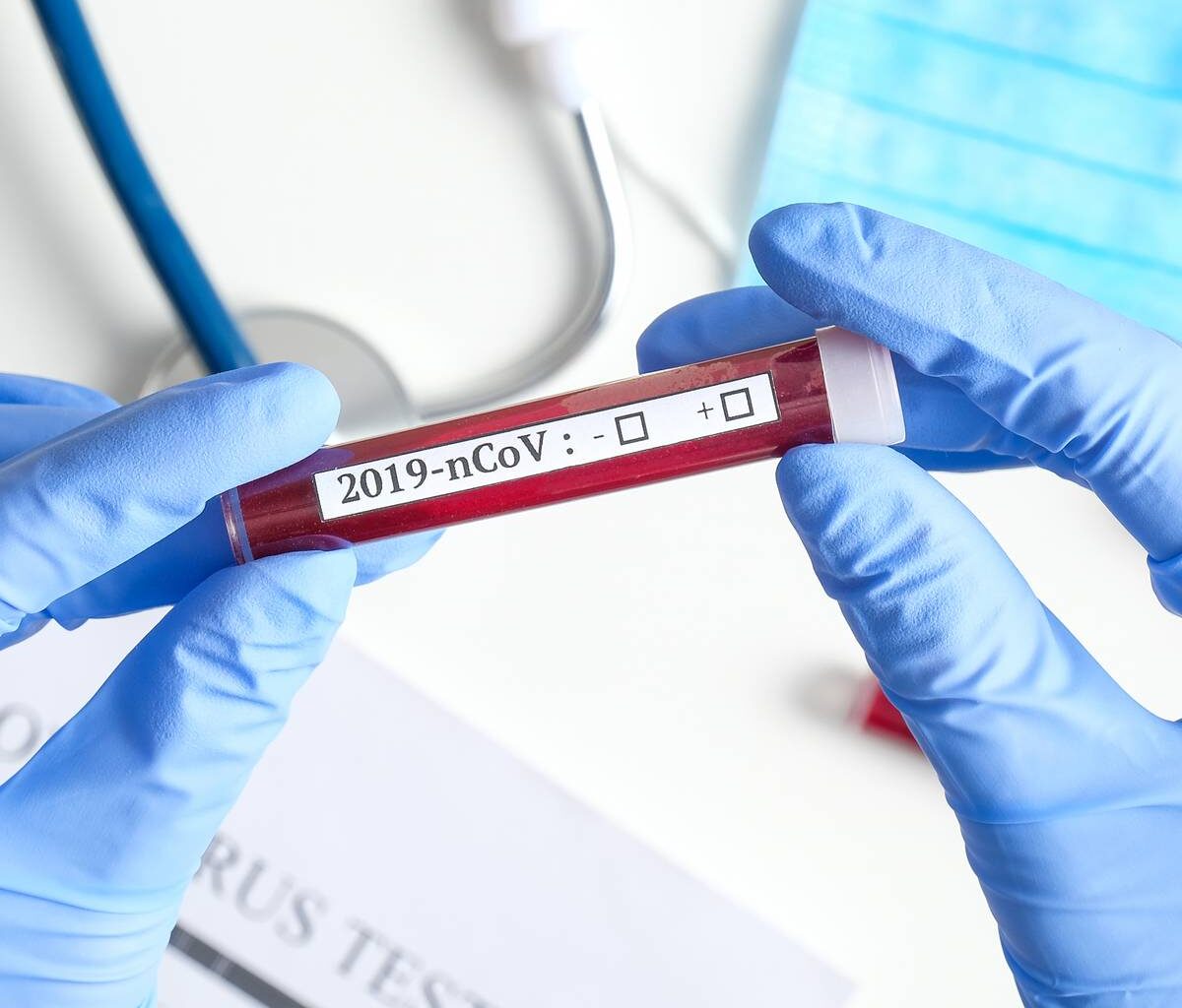 Coronazahlen aus Bochum - Radio Bochum