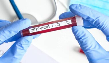 Coronazahlen aus Bochum - Radio Bochum