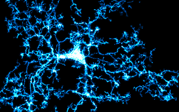 Neue Erkenntnisse zu Immunzellen im Gehirn: Charité – Universitätsmedizin Berlin
