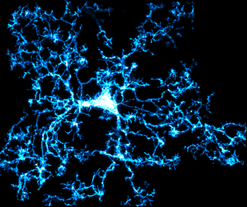 Neue Erkenntnisse zu Immunzellen im Gehirn: Charité – Universitätsmedizin Berlin