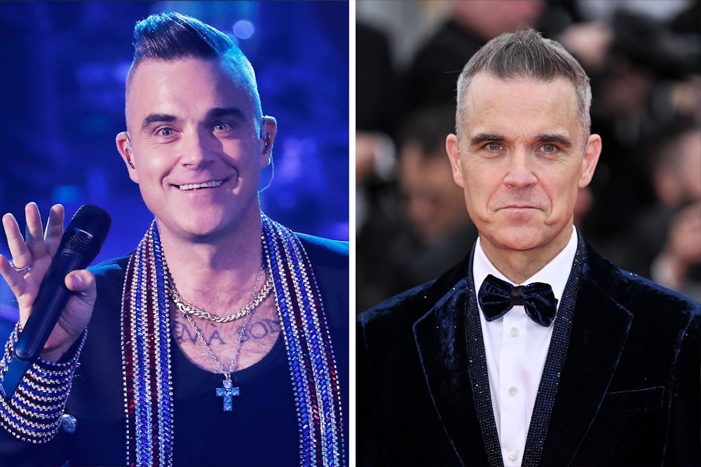 Auch bei Robbie Williams wirkt das Gesicht mittlerweile eingefallen.