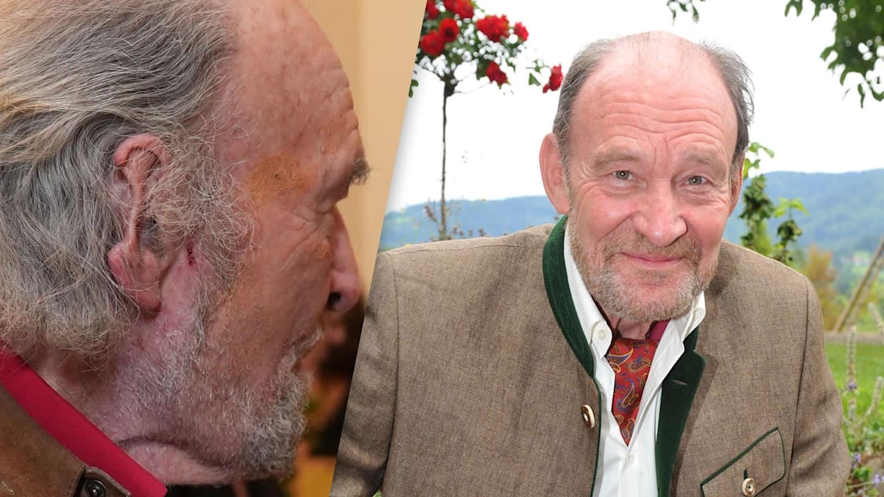 Michael Mendl: TV-Star hat nur noch ein halbes Ohr!  | Unterhaltung