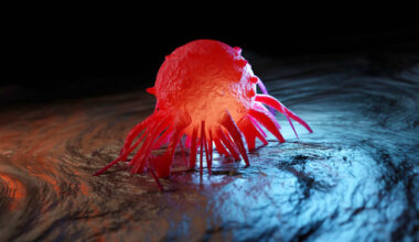 Krebs: „Bei einigen Tumorarten ist es faktisch Realität, dass man nicht mehr sterben muss“