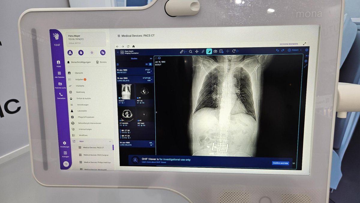 Mona: Aachener Projekt stellt Teleintensivmedizin für Europa bereit