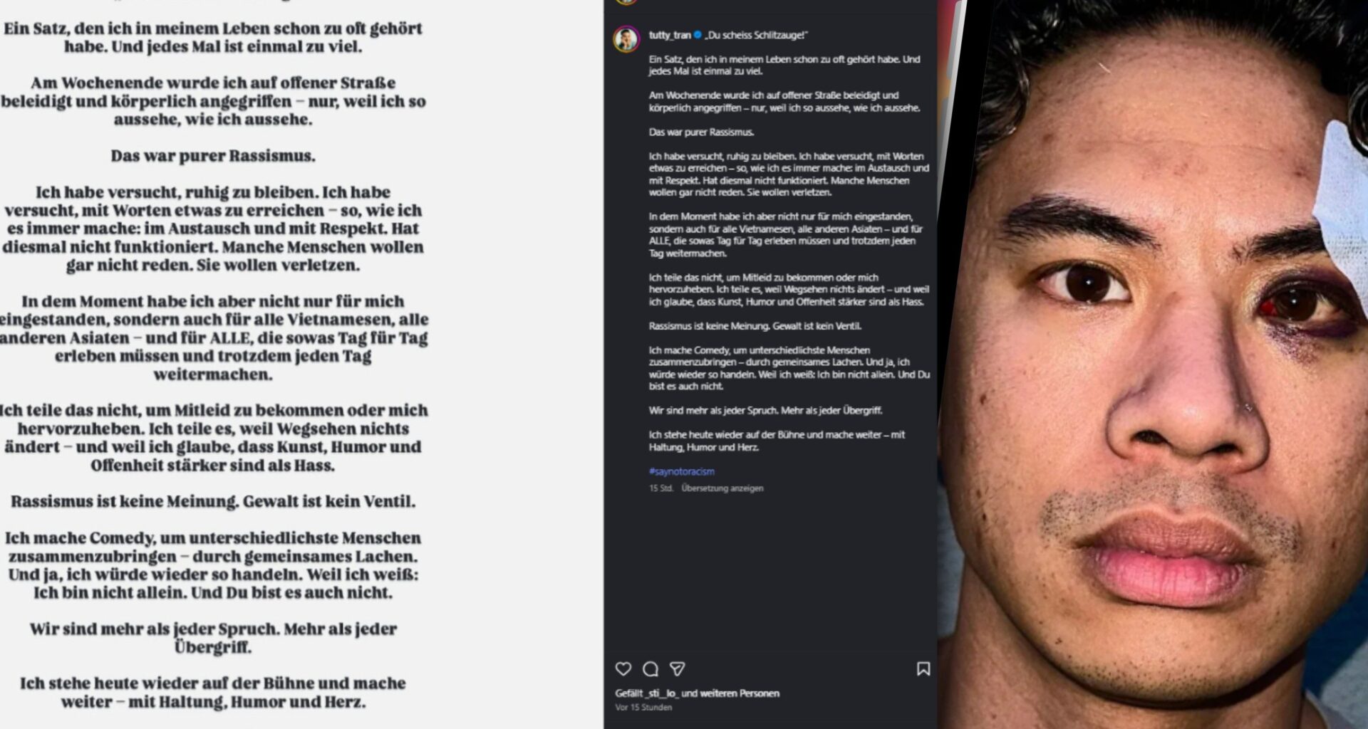 Rassismusvorwurf: Comedian Tutty Tran über Angriff