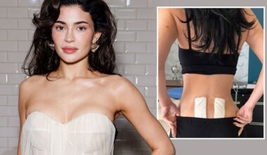 Kylie Jenner: Stammzellentherapie hilft ihren chronischen Rückenschmerzen | Unterhaltung
