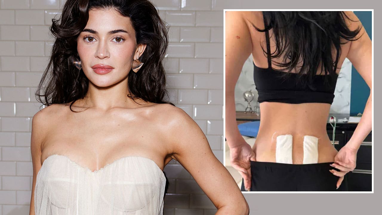Kylie Jenner: Stammzellentherapie hilft ihren chronischen Rückenschmerzen | Unterhaltung
