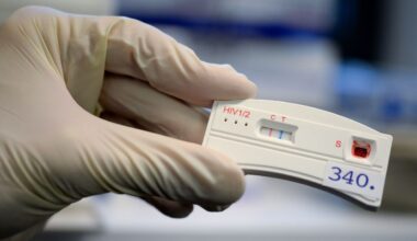 RKI rechnet erneut mit mehr HIV-Infektionen in Berlin und Brandenburg