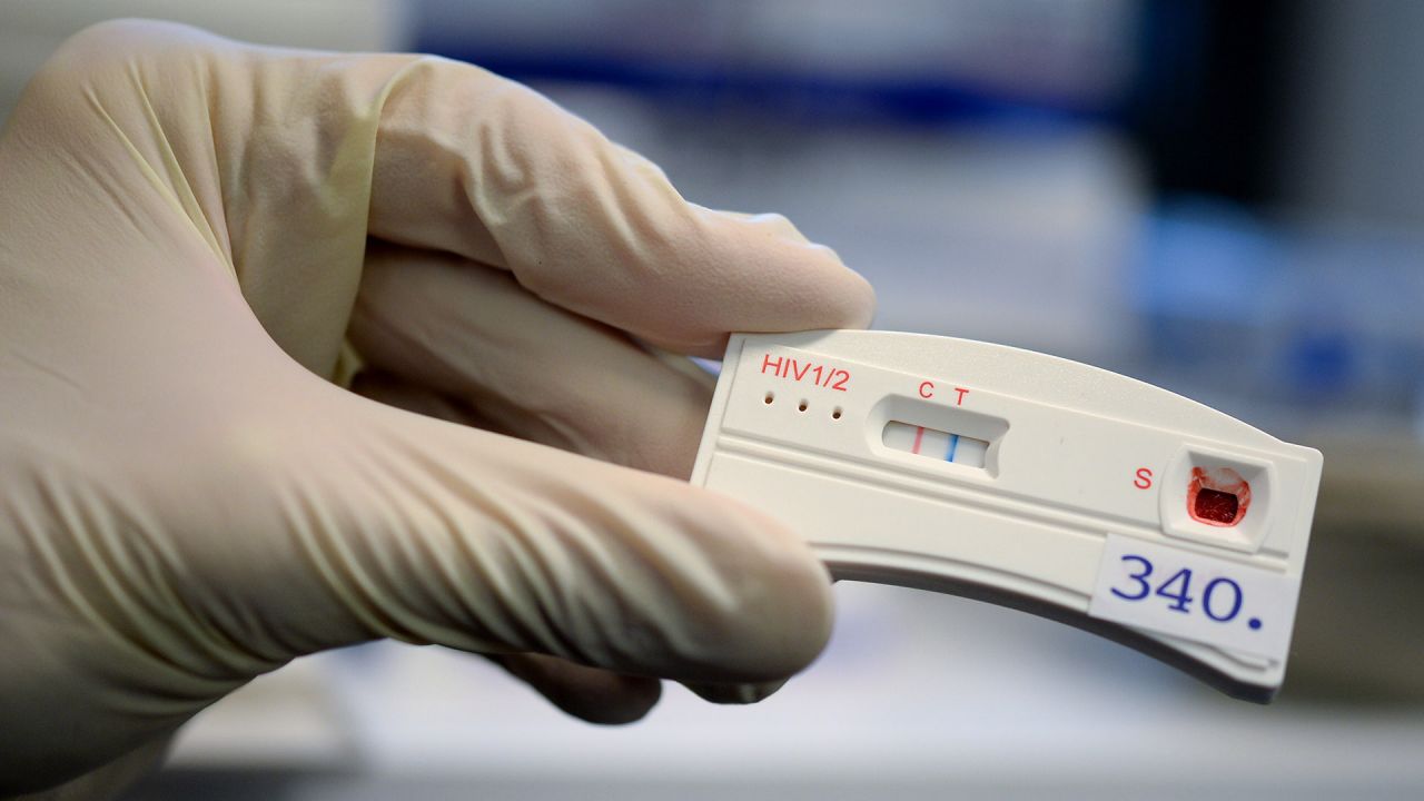 RKI rechnet erneut mit mehr HIV-Infektionen in Berlin und Brandenburg