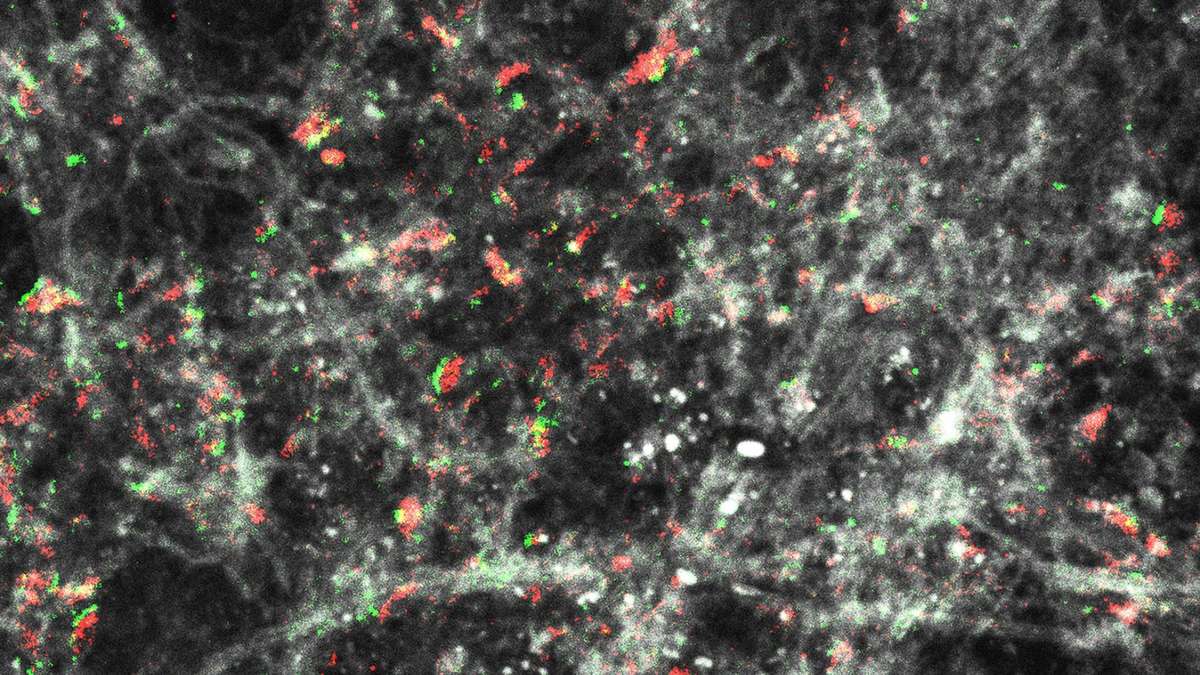 Die Forscher basteln an einem Computermodell der Synapsen im Gehirn