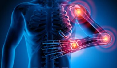 Förderung für Suche nach neuen Diagnoseverfahren für Kollagenosen – News – Deutsches Ärzteblatt