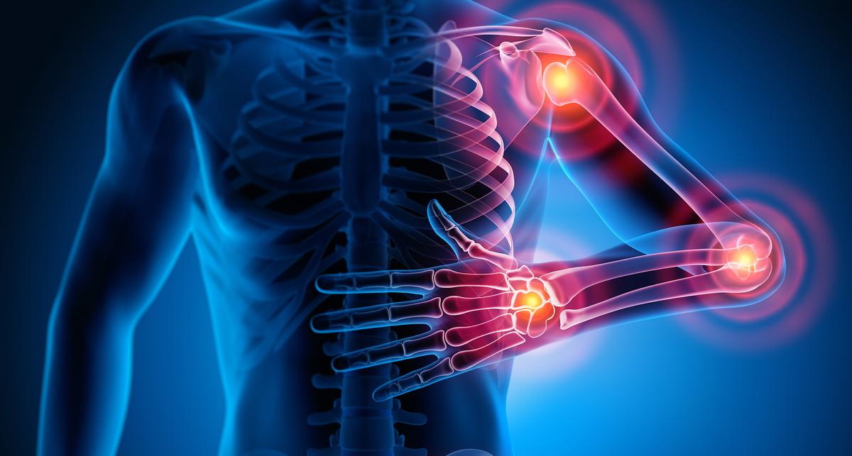 Förderung für Suche nach neuen Diagnoseverfahren für Kollagenosen – News – Deutsches Ärzteblatt