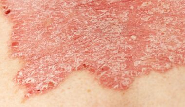 Weitere Zunahme der Krankheitsfälle bis 2050 erwartet – News – Deutsches Ärzteblatt