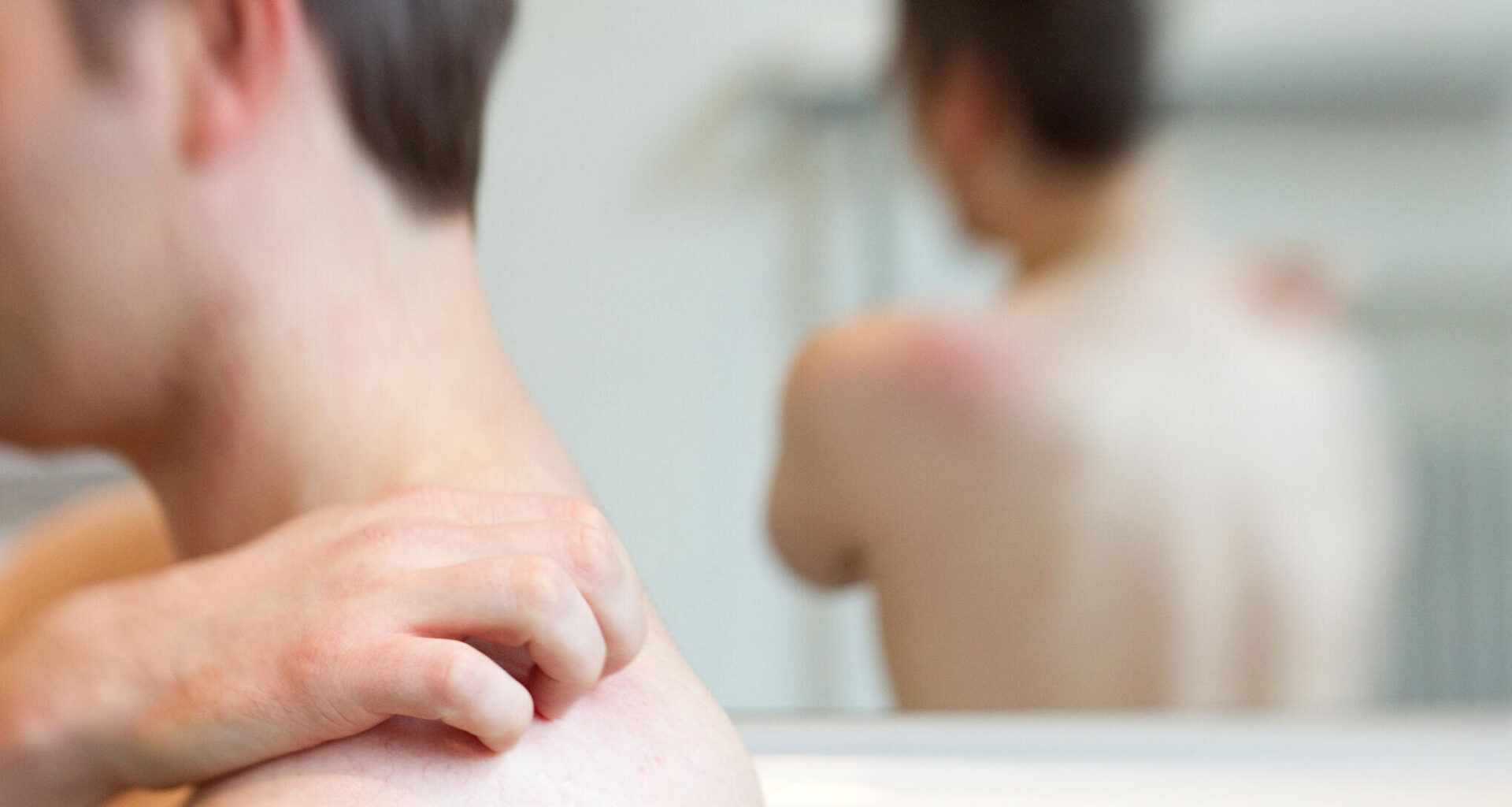 Große Impflücken bei Gürtelrose in Sachsen