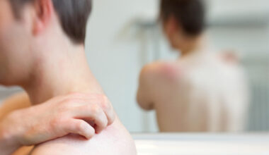 Große Impflücken bei Gürtelrose in Sachsen