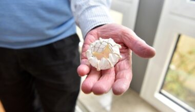 Neues Verfahren zum Herzklappenersatz erfolgreich in Bochum eingeführt