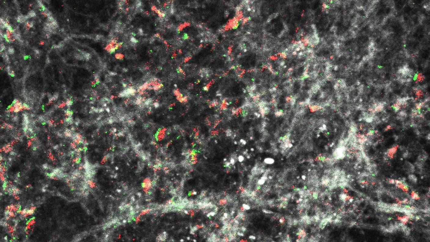 Deutsche Forschungsgemeinschaft (DFG) fördert Sonderforschungsbereich (SFB) 1286 zur Erforschung von Synapsen und Entwicklung einer computergestu?tzten Synapsen-Simulation an der Universitätsmedizin Göttingen (UMG) für weitere 3,5 Jahre. Die beantragte Fördersumme liegt bei insgesamt mehr als elf Millionen Euro. Hier: Synapsen (rot und grün) in Aktion im Gehirn (weiße Strukturen). 