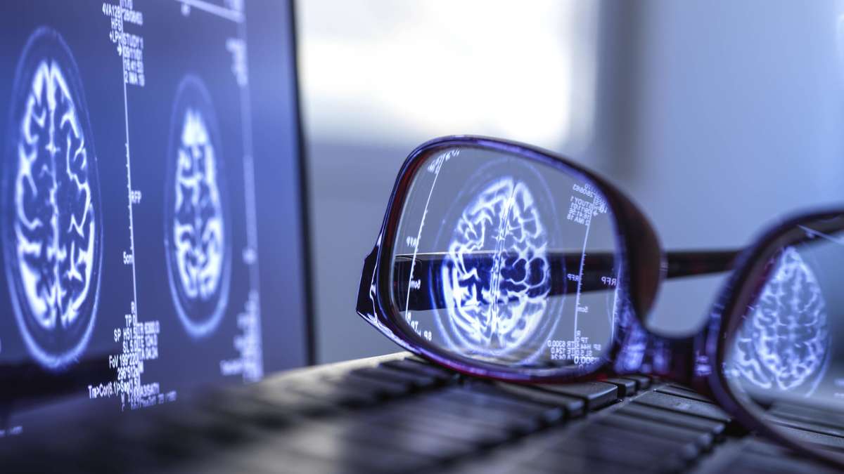 Spektakuläre Entdeckungen der Hirnforschung im Jahr 2025