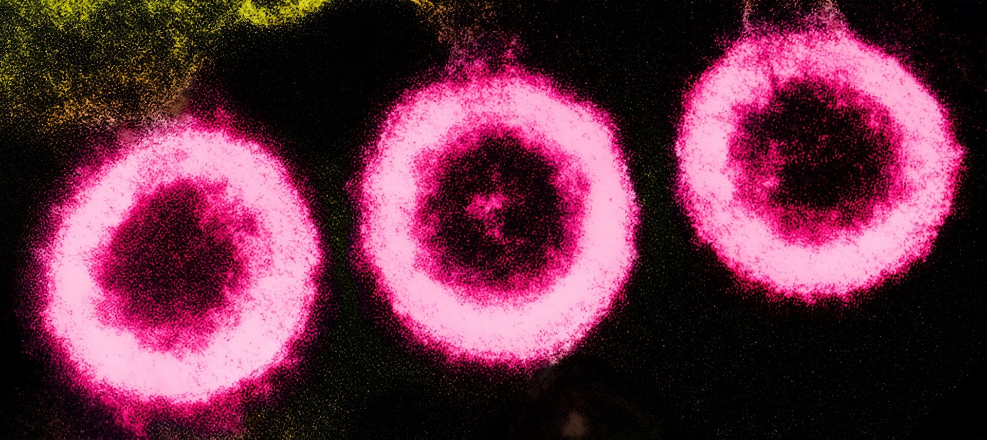 Elektronenmikroskopisches Bild von drei HIV-Partikeln (rosa), die aus der Membran einer Wirtszelle (gelblich-grün) austreten.