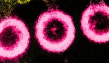 Elektronenmikroskopisches Bild von drei HIV-Partikeln (rosa), die aus der Membran einer Wirtszelle (gelblich-grün) austreten.