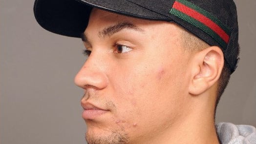 Nicht ansprechen! Polizei jagt Mann (26) in Hannover | Regional