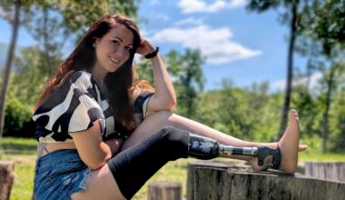 Mit Unterschenkelprothese zur Miss Deutschland?