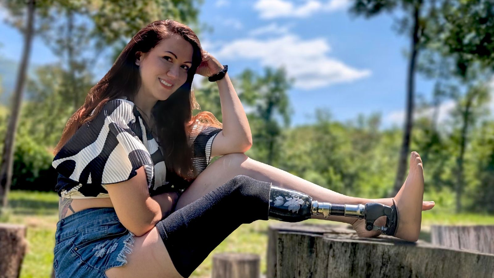 Mit Unterschenkelprothese zur Miss Deutschland?