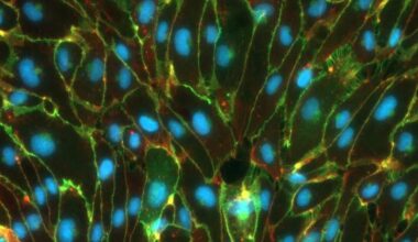 Blut-Hirn-Schranke im Labor nachgebaut - 2025 - Innovation & Medizintechnik