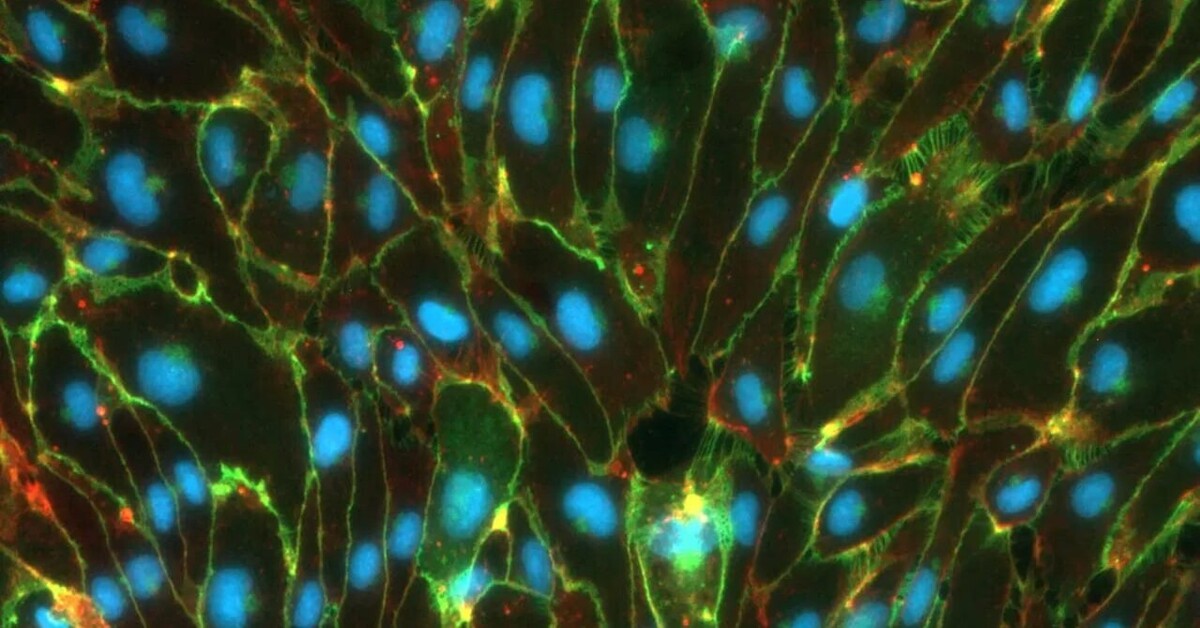 Blut-Hirn-Schranke im Labor nachgebaut - 2025 - Innovation & Medizintechnik