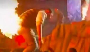 Zu heißes Temperament: Fan flambiert sich den Po | News