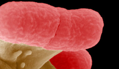 Antibiotika-Resistenz: KI-Vorhersagen unzuverlässig - Universität Würzburg