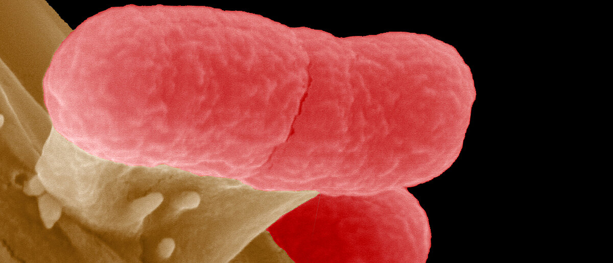 Antibiotika-Resistenz: KI-Vorhersagen unzuverlässig - Universität Würzburg