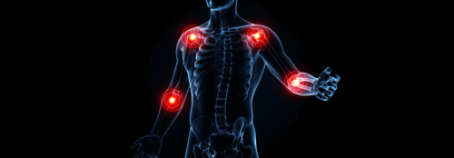 Wie rheumatoide Arthritis Körperfett, Insulinbedarf und Lipide verändert