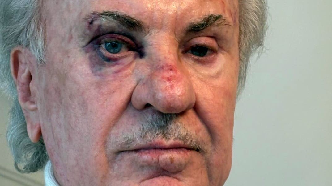 Stuttgart: Wurde Willi Weber von Serienräubern gefoltert? | Regional