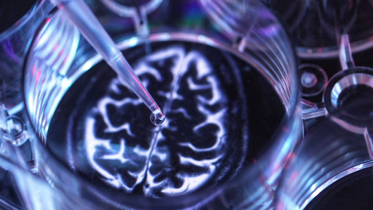 Nach Gürtelrose-Impfung – „Wir sehen immer wieder ein starkes Schutzsignal für Demenz“