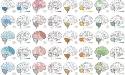 Hirntumor-KI erkennt jetzt über 180 Tumorarten • healthcare-in-europe.com