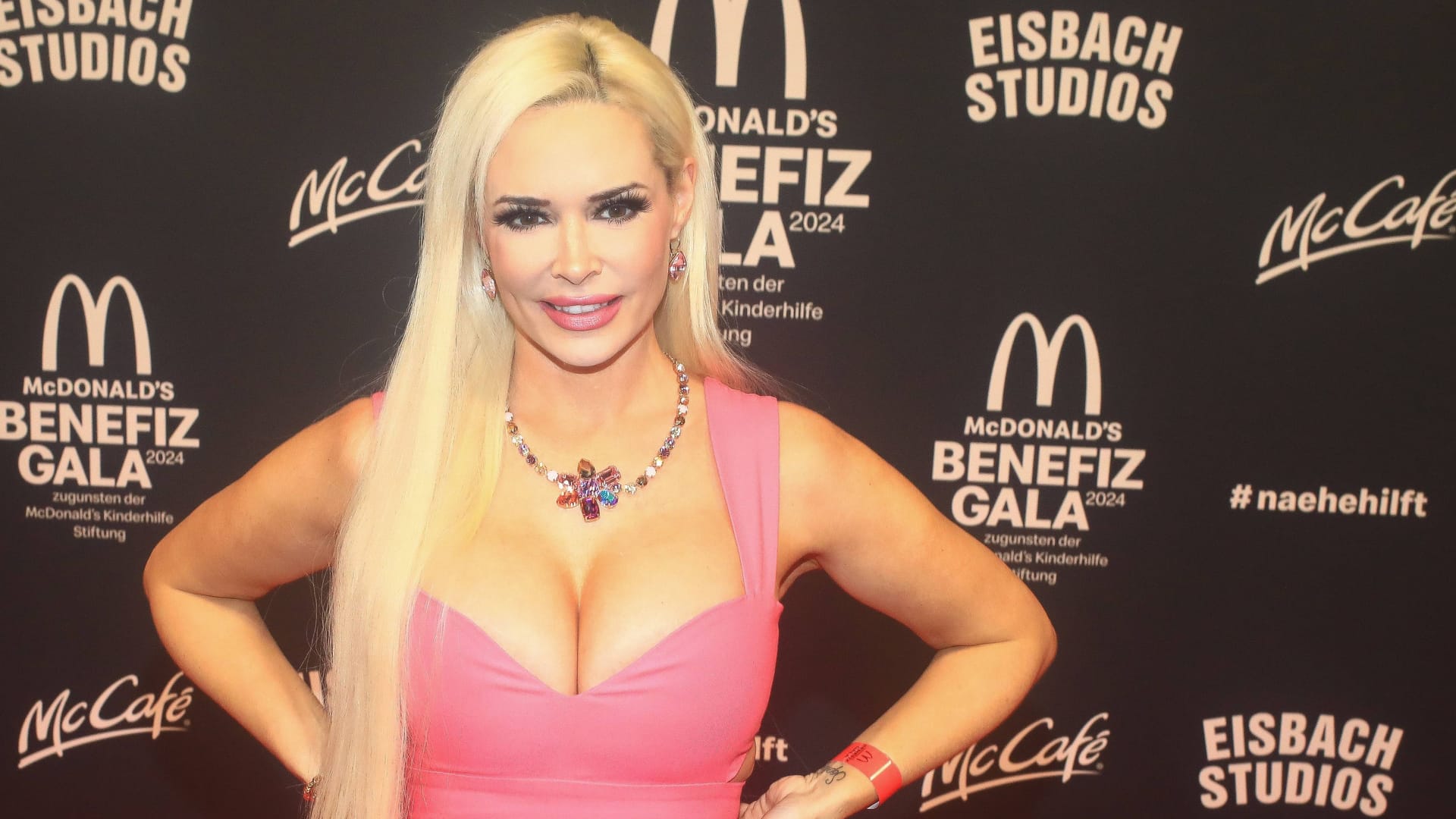 TV-Star Daniela Katzenberger: Sie steht offen zu ihren Beautyeingriffen.