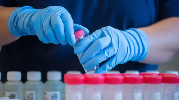 Eine Labormitarbeiterin hält einen Probenbehälter mit behandschuhten Händen. 